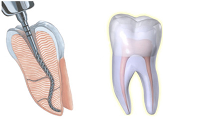 CONSERVATIVA ED ENDODONZIA